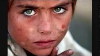 PEOPLE WITH UNUSUAL EYES, HAIR AND SKIN COMBINATIONS 2