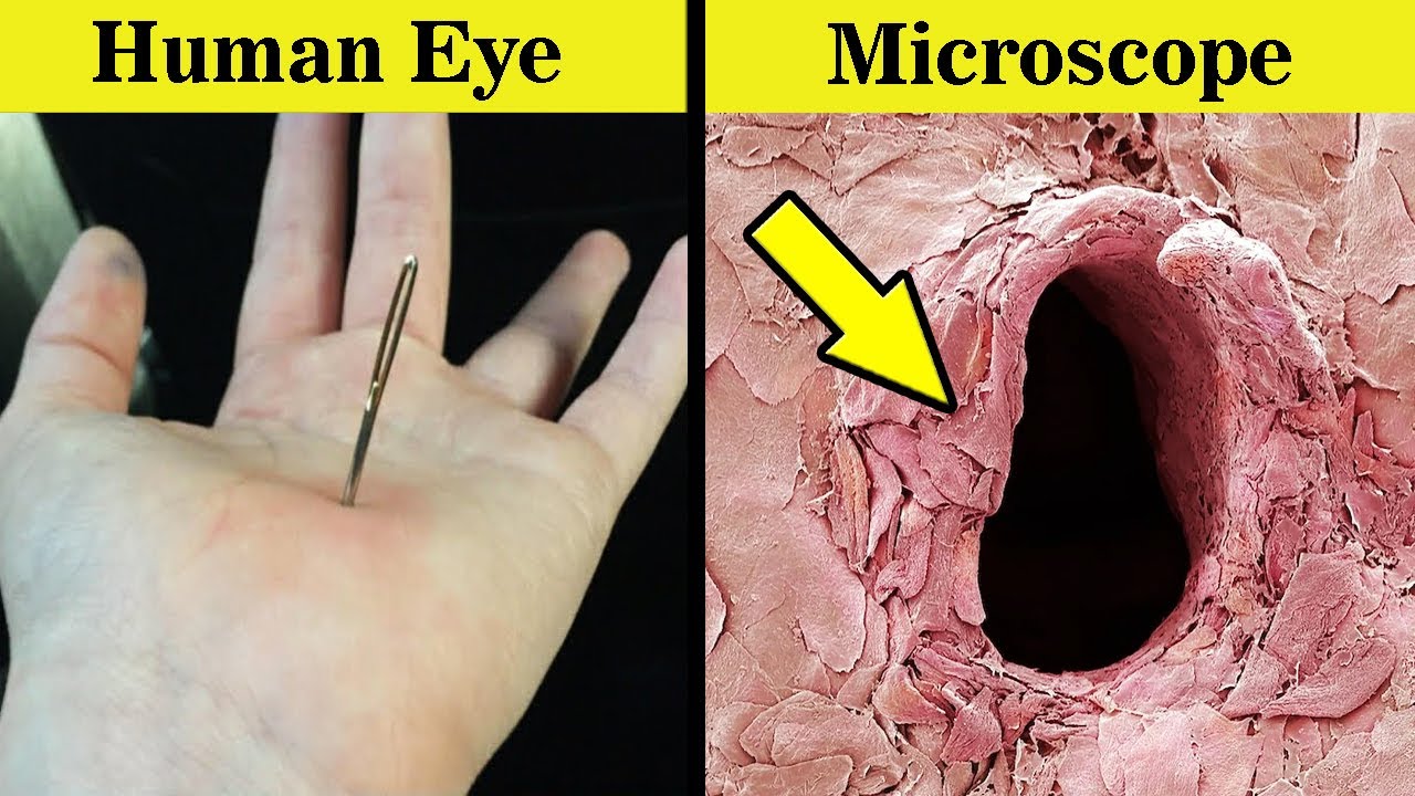 8 Things You Can See Only Under Microscope