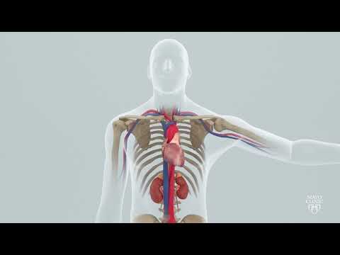 Intra Aortic Balloon Pump (IABP)