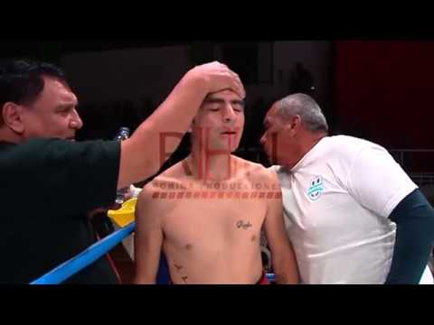 Boxeo - Brian EL BOMBARDERO Avila vs Guido MARAVILLA Gomez