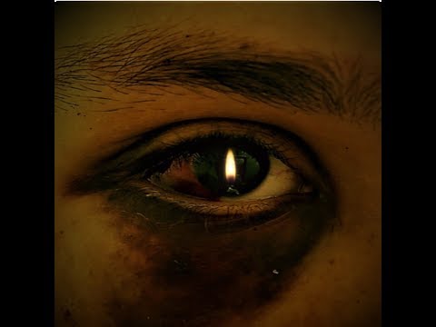 Bullet To The Head (B.T.T.H) - Sonny Z [Official Video] (Duppy Freestyle Remix)