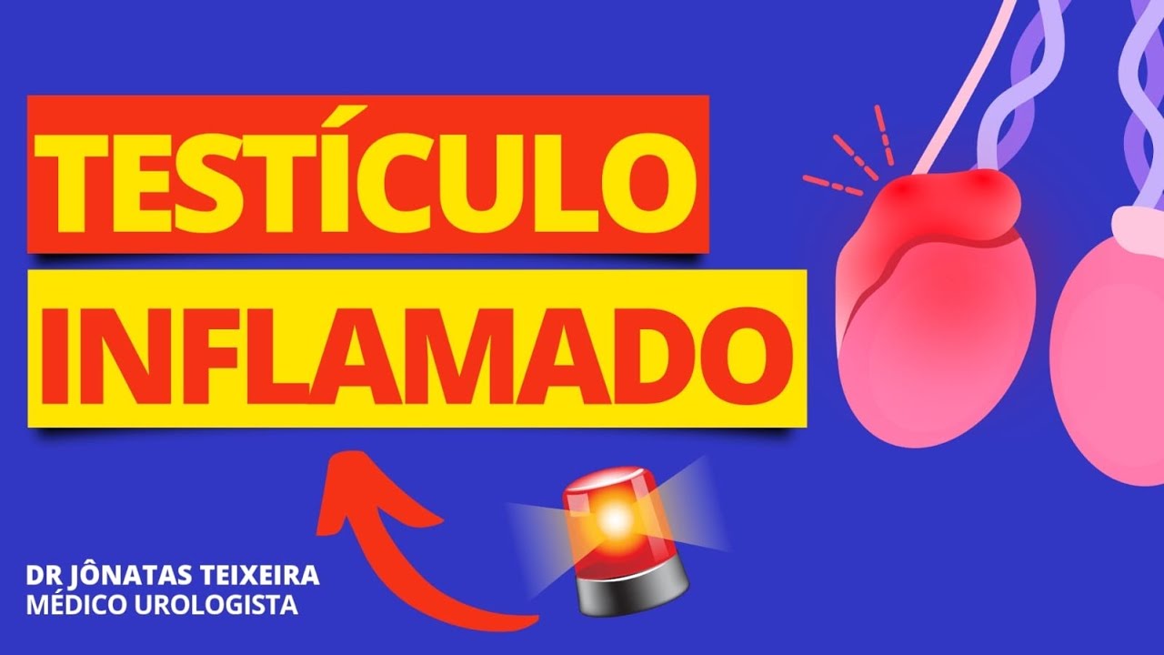 INFLAMAÇÃO DO TESTÍCULO (ORQUIEPIDIDIMITE)