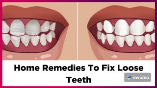 Home Remedies To Tighten & Strengthen Loose Teeth!