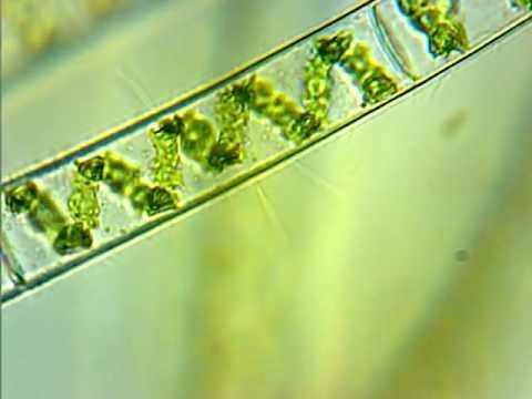Spirogyra Algae Cells With Hair? 600X
