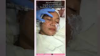 Download lagu SKIN BOOSTER BEFORE AND AFTER#skinbooster mp3