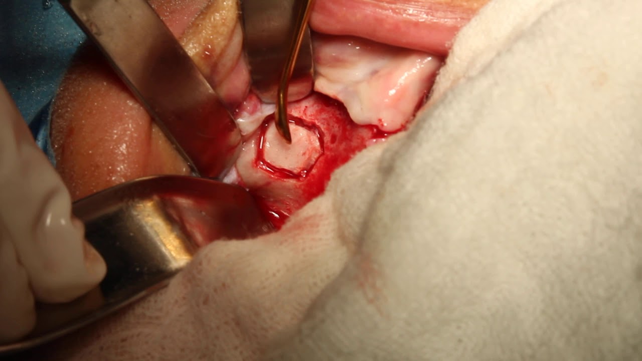 Zeyda Oliman Hoyos-13