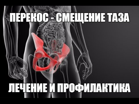 Гиалурованная кислота для коленного сустава Болит поясница при лежании и сидении