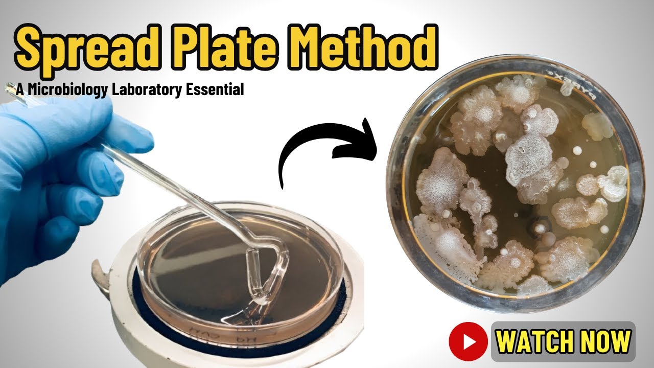 Spread Plate Method: Principles, Procedure, and Applications | A Microbiology Laboratory Essential