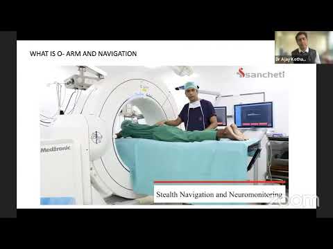 Robotic O arm and navigation surgery