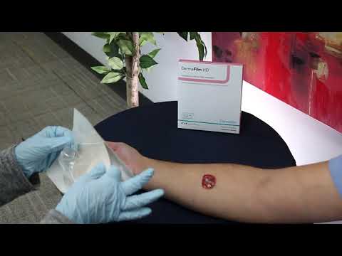 How to Apply DermaRite's XeroForm Wound Dressing