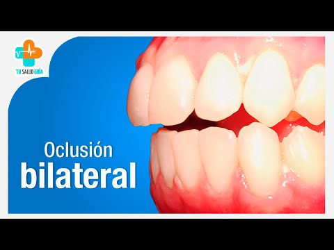 Oclusión Bilateral | Tu Salud Guía