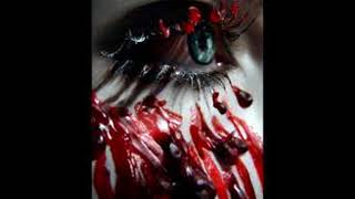 Media Lab - My Eyes Are Bleeding