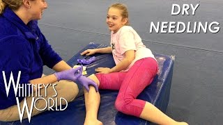 Dry Needling | Tough Gymnast | Stick a Needle in my Knees Please