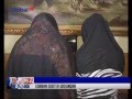 Alami Infeksi Zat Kimia 2 Korban Dokter Kecantikan Gadungan Membuat BAP BIS 22 05