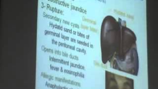 Dr Azza 7 13 11 2014   YouTube