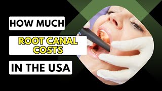 How Much Does Root Canal Cost in the United States?