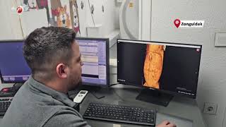 Dört Yıldır Kusan Kedinin Midesinden Buzdolabı Vakumu Çıktı