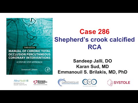 Case 286: Manual of CTO PCI - Shepherd’s crook calcified RCA