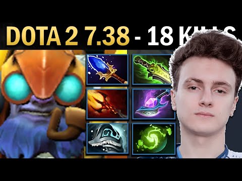 Tinker Gameplay Miracle with 18 Kills and Shivas - Dota 7.38