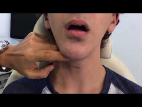 Parmaklarla Puberphonia Tedavisi