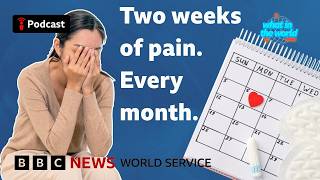 Severe depression before your period. PMDD explained - What in the World podcast, BBC World Service