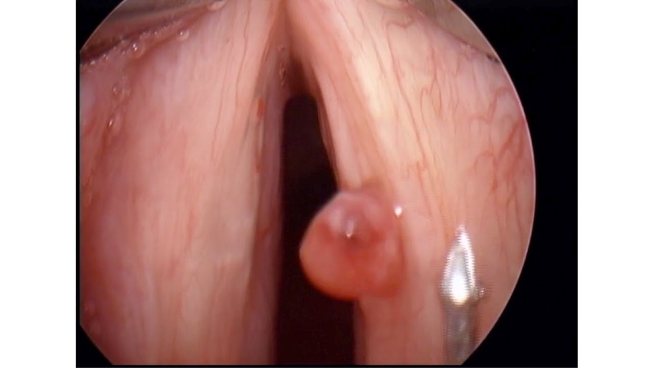 Joaquín Archibaldo Hope Guerrero-8