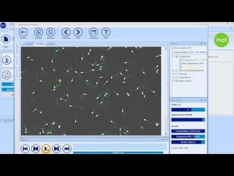 SCA Motility and concentration - CASA System SCA Evolution (Veterinary Edition)