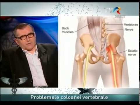 Simptomele artritei coloanei vertebrale