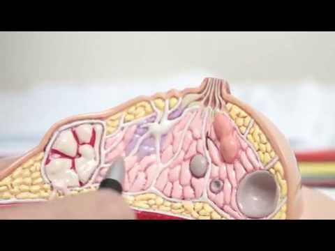 เต้านม implants eurosilicone หนังโป๊สีบลอนด์หัวนมขนาดเล็ก