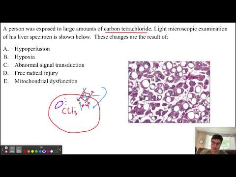 USMLE Q 103: Free Radical Injury