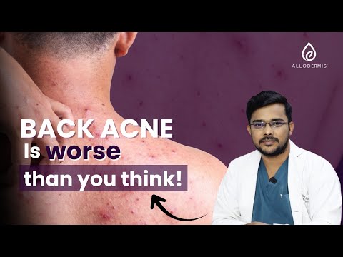 Allodermis video