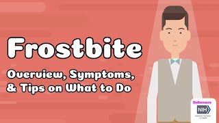 Frostbite - Overview, Symptoms, & Tips on What to Do