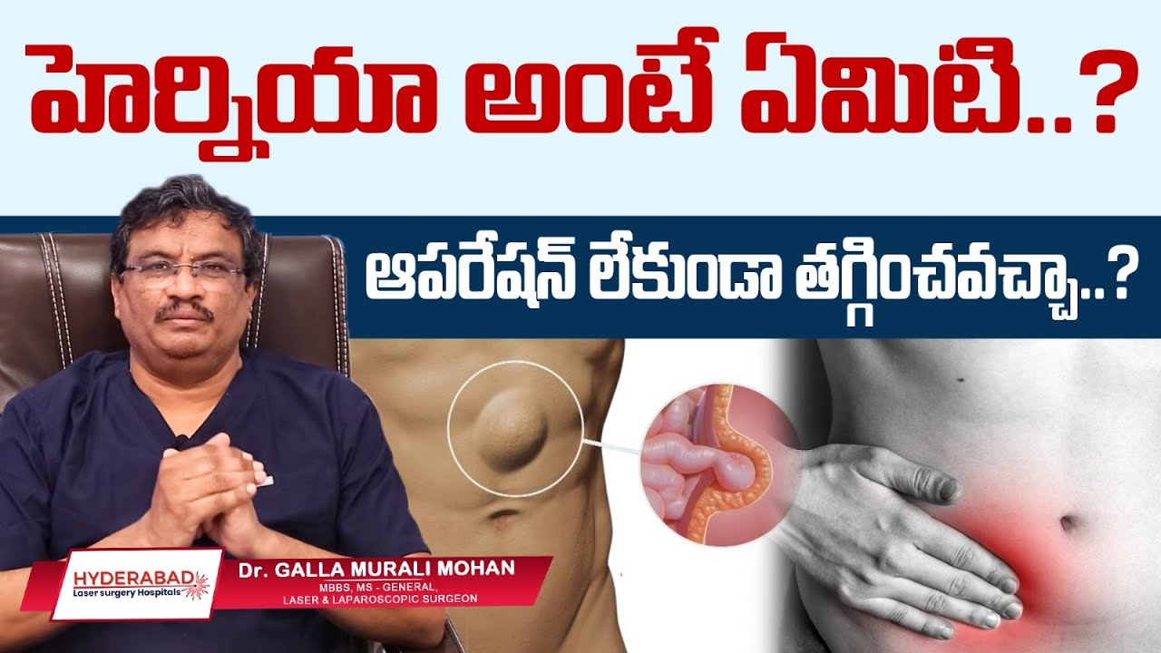 Hernia Surgery Video - Hyderabad Laser Surgery Hospital