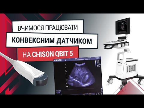 Конвексный датчик к Chison Qbit 5 – обучение и функции - Статьи RH