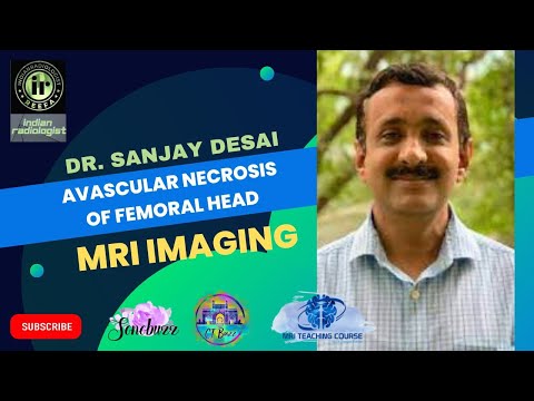 AVASCULAR NECROSIS OF FEMORAL HEAD || DR SANJAY DESAI || #mriteachingcourse