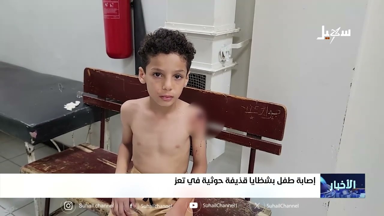 إصابة طفل بشظايا قذيفة حوثية في تعز