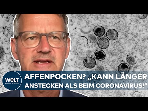 AFFENPOCKEN IN DEUTSCHLAND: "Man kann länger Menschen anstecken als beim Coronavirus" I Interview