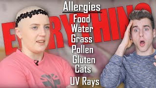 Meet The Girl Who&#39;s Allergic To Everything