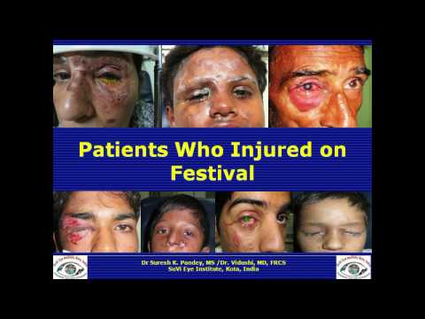 Festival Related Eye Injuries in India