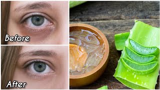 How to remove dark circles naturally (100% Results)