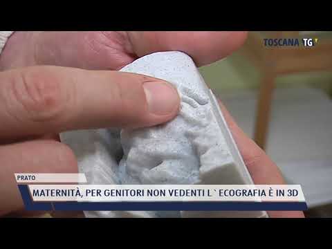 2022-02-17 PRATO - MATERNITÀ, PER GENITORI NON VEDENTI L'ECOGRAFIA È IN 3D
