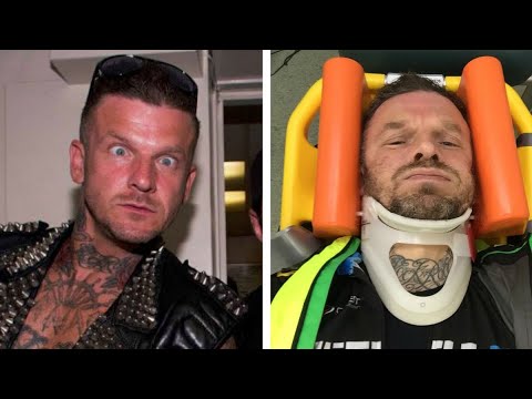 Dirty Sanchez star gets stabbed