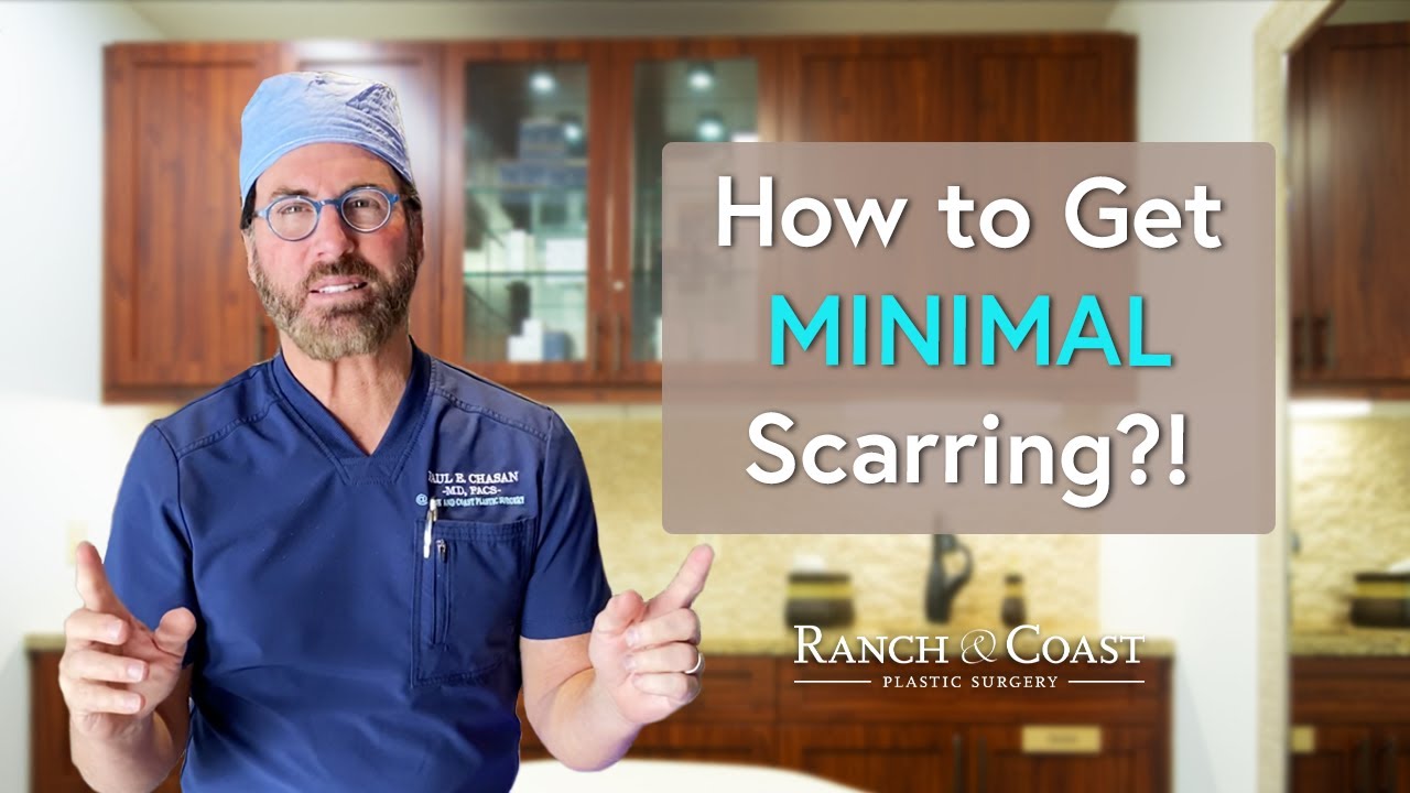 How to Improve Your Scarring