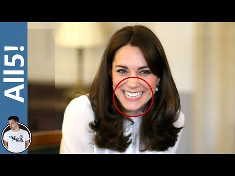 Actress With Underbite