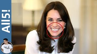 5 Celebrities With Underbites!