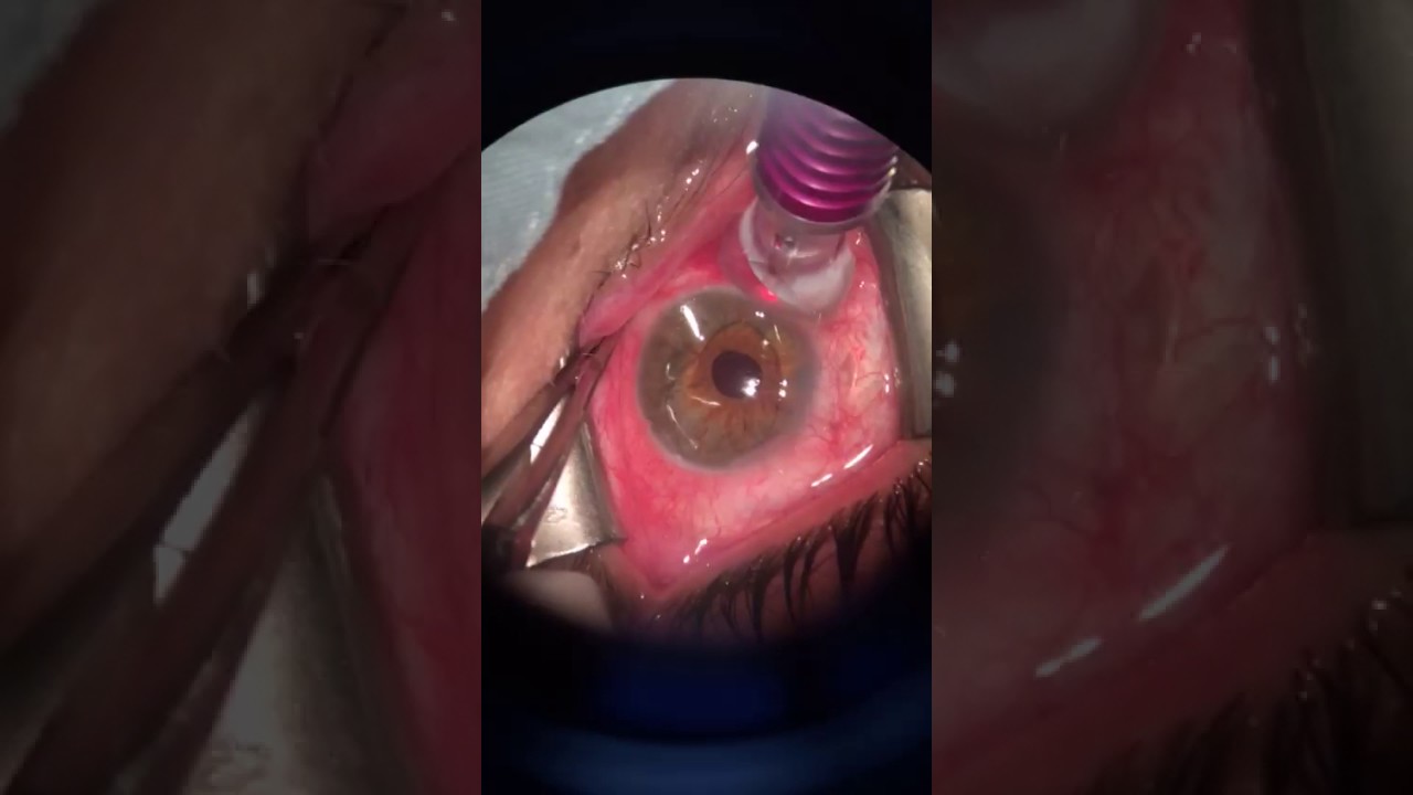 Hector Dario Forero Angel-52