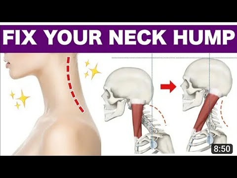 How to Fix a Neck Hump and Slim Face✨can be done while standing