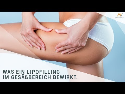 Wie die toten Bienen von Gelenken auf Wodka bestehen Schmerzen in der linken Schulter bis zum Hals erstreckt
