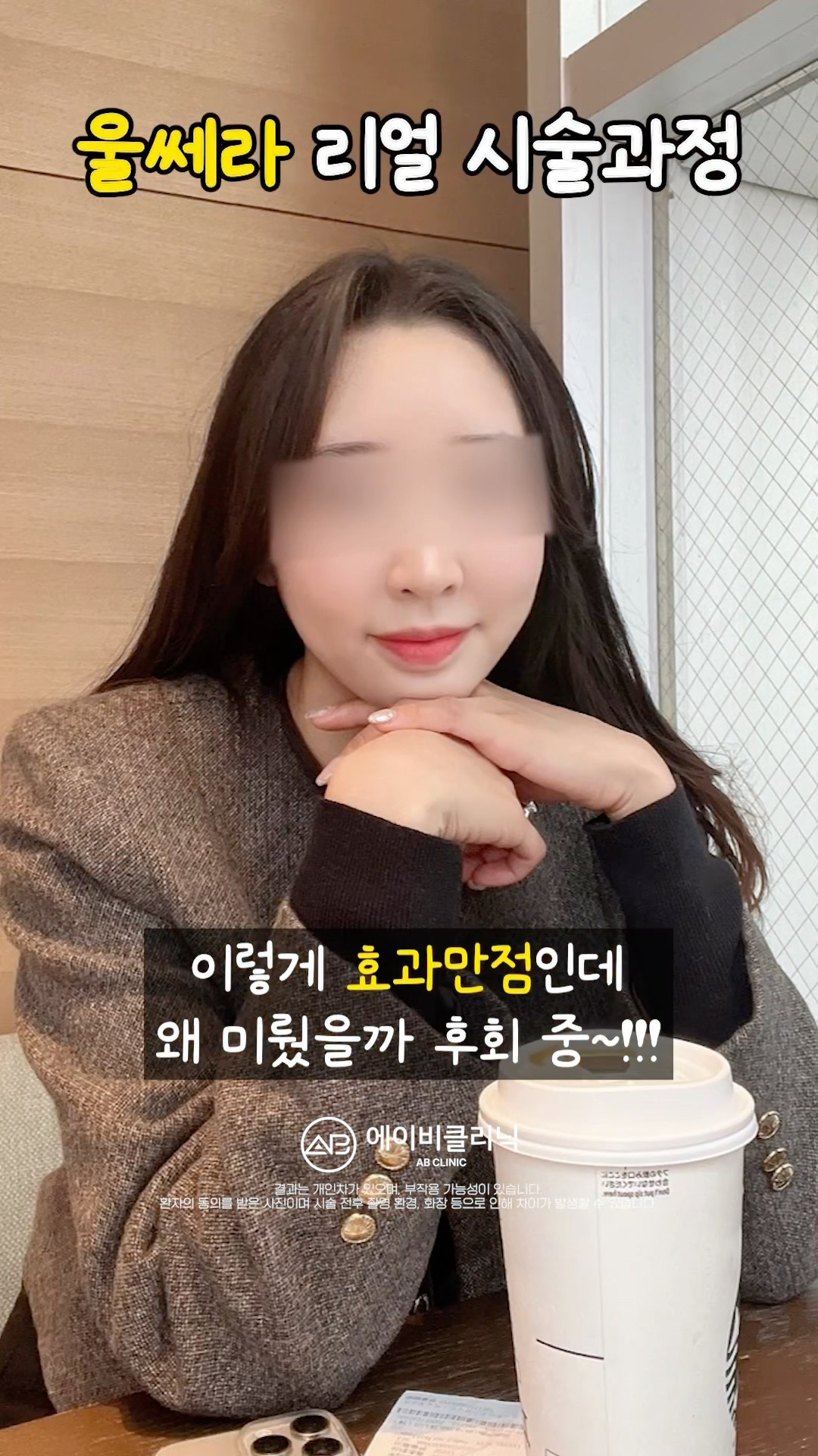 늘어진 턱살 울쎄라로 정리하기❤️‍🔥