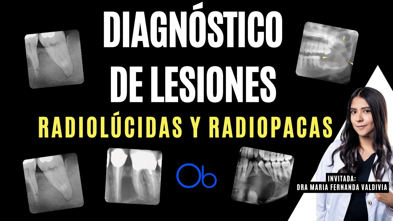 Ver video — La patología bucal explicada por la Dra. Fernanda Valdivia